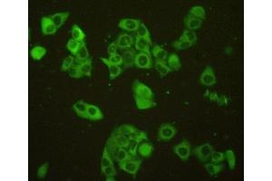 Detection of Sp100 in MCF7 cells using Polyclonal Antibody to Sp100 Nuclear Antigen (Sp100) (SP100 抗体  (AA 610-802))
