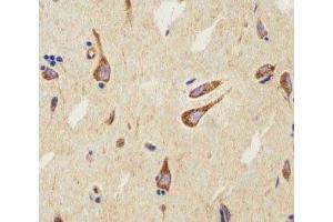 IHC analysis of FFPE human brain using CB2 antibody at 1:25. (CNR2 抗体  (AA 329-356))
