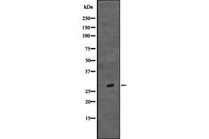 Western blot analysis of CD48 expression in Jurkat cell lysate,The lane on the left is treated with the antigen-specific peptide.
