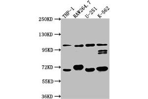 Western Blot Positive WB detected in: THP-1 whole cell lysate, RAW264. (Recombinant TLR5 抗体)
