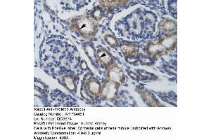 Human kidney (TRIM68 抗体  (Middle Region))