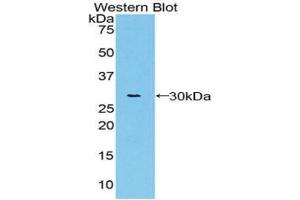Detection of Recombinant vWA1, Rat using Polyclonal Antibody to Von Willebrand Factor A Domain Containing Protein 1 (vWA1) (VWA1 抗体  (AA 43-285))