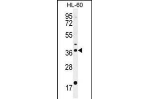 Western blot analysis in HL-60 cell line lysates (35ug/lane). (OR2W3 抗体  (C-Term))