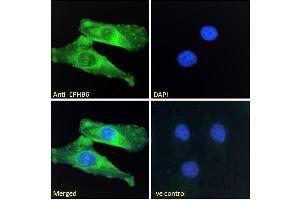 ABIN7013872 Immunofluorescence analysis of paraformaldehyde fixed HeLa cells, permeabilized with 0. (EPH Receptor B6 抗体  (Internal Region))