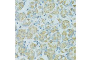 Immunohistochemistry (Paraffin-embedded Sections) (IHC (p)) image for anti-Tight Junction Protein 2 (Zona Occludens 2) (TJP2) (AA 951-1190) antibody (ABIN1683322)