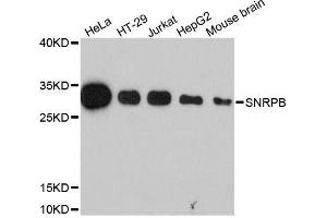 Western blot analysis of extracts of various cell lines, using SNRPB antibody (ABIN5995789) at 1:3000 dilution. (SNRPB 抗体)