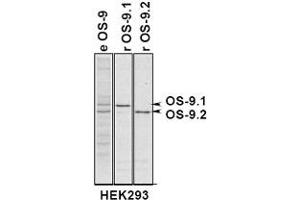 Immunoprecipitation of OS9 in 293 cells expressing OS9. (OS9 抗体  (AA 300-400))