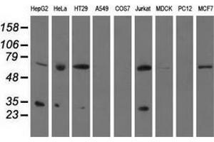 Western blot analysis of extracts (35 µg) from 9 different cell lines by using anti-PYCR2 monoclonal antibody. (PYCR2 抗体)