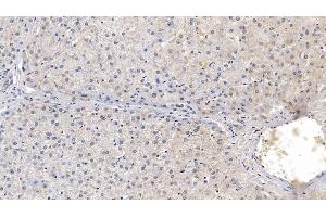 Detection of LCAT in Human Liver Tissue using Monoclonal Antibody to Lecithin Cholesterol Acyltransferase (LCAT) (LCAT 抗体  (AA 290-433))