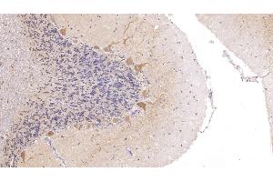 Detection of CALB in Human Cerebellum Tissue using Polyclonal Antibody to Calbindin (CALB) (CALB1 抗体  (AA 3-261))