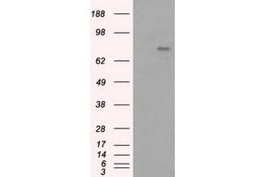 Image no. 7 for anti-Bruton Agammaglobulinemia tyrosine Kinase (BTK) antibody (ABIN1496974) (BTK 抗体)