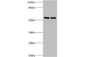 Western blot All lanes: TRIM27 antibody at 4 μg/mL Lane 1: Jurkat whole cell lysate Lane 2: HepG2 whole cell lysate Secondary Goat polyclonal to rabbit IgG at 1/10000 dilution Predicted band size: 59, 42 kDa Observed band size: 59 kDa (TRIM27 抗体  (AA 214-513))