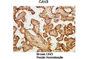 Sample Type :  Human placental tissue   Primary Antibody Dilution :   1:50  Secondary Antibody :  Goat anti rabbit-HRP   Secondary Antibody Dilution :   1:10,000  Color/Signal Descriptions :  Brown: CAV3 Purple: Haemotoxylin  Gene Name :  CAV3  Submitted by :  Dr.