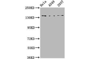 Western Blot Positive WB detected in: Hela whole cell lysate, A549 whole cell lysate, 293T whole cell lysate All lanes: CNGB1 antibody at 4. (GARP 抗体  (AA 131-253))