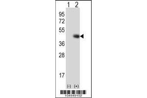Western blot analysis of TPST1 using rabbit polyclonal TPST1 Antibody (K351) using 293 cell lysates (2 ug/lane) either nontransfected (Lane 1) or transiently transfected (Lane 2) with the TPST1 gene. (TPST1 抗体  (C-Term))