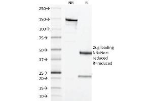 SDS-PAGE Analysis of Purified CD68 Mouse Monoclonal Antibody ABIN6383883. (CD68 抗体  (Extracellular Domain))