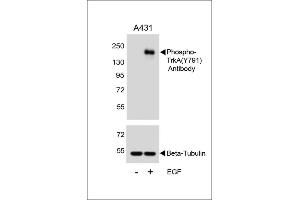 Western blot analysis of lysates from A431 cell line, untreated or treated with EGF, 100 ng/mL, using Phospho-TrkA Antibody (ABIN389679 and ABIN2839650) (upper) or Beta-Tubulin (lower). (TRKA 抗体  (pTyr791))