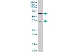 SMAD3 monoclonal antibody (M21), clone 2G4 Western Blot analysis of SMAD3 expression in HeLa . (SMAD3 抗体  (AA 147-270))