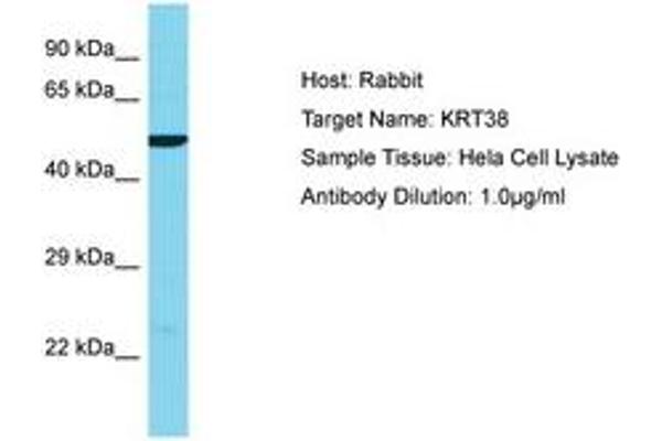 KRT38 抗体  (AA 206-255)