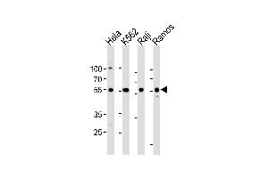 RELA Antibody (Center) (ABIN1881740 and ABIN2838805) western blot analysis in Hela,K562,Raji,Ramos cell line lysates (35 μg/lane). (NF-kB p65 抗体  (AA 166-195))