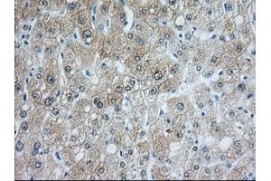 Image no. 10 for anti-Acetyl-CoA Acetyltransferase 2 (ACAT2) antibody (ABIN1496401) (ACAT2 抗体)