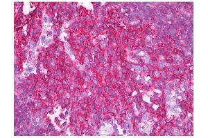 Image no. 1 for anti-Synaptosomal-Associated Protein, 23kDa (SNAP23) antibody (ABIN347010) (SNAP23 抗体)