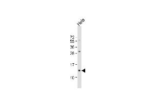 Anti-B2M Antibody (N-term) at 1:1000 dilution + Hela whole cell lysate Lysates/proteins at 20 μg per lane. (beta-2 Microglobulin 抗体  (N-Term))