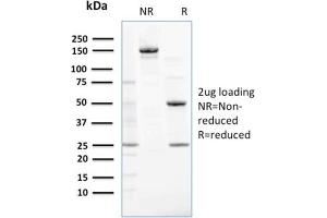 SDS-PAGE (SDS) image for anti-Nucleoside diphosphate kinase B (NME2) antibody (ABIN6940215)