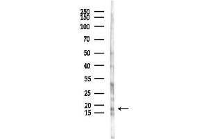 anti-BCL2-Like 15 (BCL2L5) antibody
