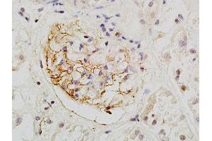 Formalin-fixed and paraffin embedded human kidney labeled with Rabbit Anti-PCX/PODXL Polyclonal Antibody, Unconjugated  at 1:200 followed by conjugation to the secondary antibody and DAB staining (PODXL 抗体  (AA 451-558))