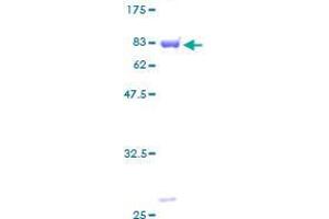 DBNL Protein (AA 1-430) (GST tag)