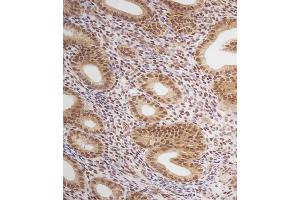 Immunohistochemistry (Paraffin-embedded Sections) (IHC (p)) image for anti-Estrogen Receptor 1 (ESR1) (AA 246-273) antibody (ABIN657470)