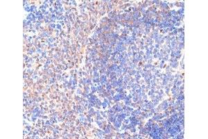 Immunohistochemistry (Paraffin-embedded Sections) (IHC (p)) image for anti-Chemokine (C-X-C Motif) Ligand 12 (CXCL12) antibody (ABIN7008123)