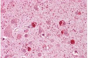 Anti-GSX2 / GSH2 antibody IHC staining of human brain, cortex. (GSX2 抗体  (N-Term))