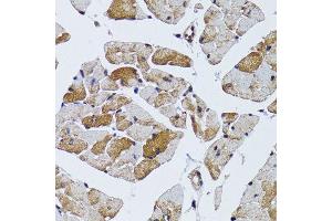 Immunohistochemistry of paraffin-embedded mouse heart using MRPS6 antibody (ABIN6003616) at dilution of 1/100 (40x lens). (MRPS6 抗体)