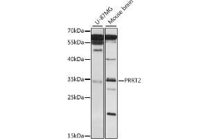 Western blot analysis of extracts of various cell lines, using PRRT2 antibody (ABIN7269559) at 1:1000 dilution. (PRRT2 抗体  (AA 20-130))
