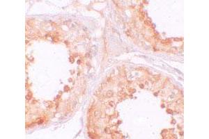 Immunohistochemical staining of human testis cells with YBX2 polyclonal antibody  at 10 ug/mL. (YBX2 抗体  (C-Term))
