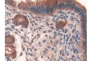 Detection of GR in Mouse Uterus Tissue using Polyclonal Antibody to Glutathione Reductase (GR) (Glutathione Reductase 抗体  (AA 240-500))