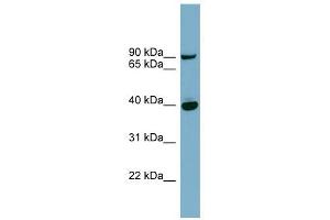 PNPLA8 antibody used at 1 ug/ml to detect target protein. (PNPLA8 抗体  (Middle Region))
