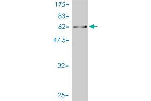 Western Blot detection against Immunogen (61. (CDK13 抗体  (AA 1-324))