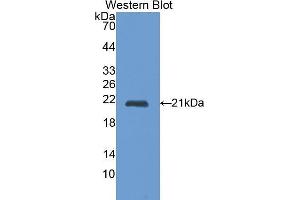 Western Blotting (WB) image for anti-Cathepsin L1 (CTSL1) (AA 114-288) antibody (ABIN1172740) (Cathepsin L 抗体  (AA 114-288))