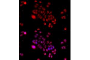 Immunofluorescence analysis of HeLa cells using DNAJB6 antibody. (DNAJB6 抗体  (AA 177-326))