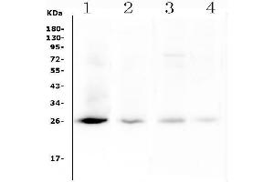 Western blot analysis of Timp-1 using anti-Timp-1 antibody (ABIN7601210).