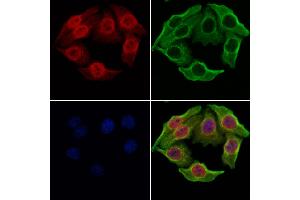 ABIN6264918 and ABIN6277937 staining Hela cells by IF/ICC. (SALL4 抗体  (Internal Region))