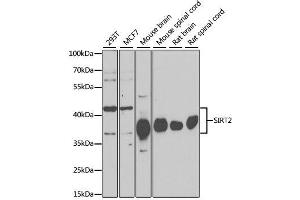 Western blot analysis of extracts of various cell lines, using SIRT2 antibody. (SIRT2 抗体)