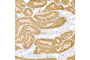 Immunohistochemistry (IHC) image for anti-Dopa Decarboxylase (Aromatic L-Amino Acid Decarboxylase) (DDC) (AA 1-100) antibody (ABIN1679510)