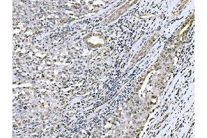 IHC analysis of Nac1/NACC1 using anti-Nac1/NACC1 antibody (ABIN7599756).