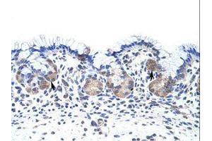 Image no. 1 for anti-UPF3 Regulator of Nonsense Transcripts Homolog B (UPF3B) (N-Term) antibody (ABIN203166) (UPF3B 抗体  (N-Term))