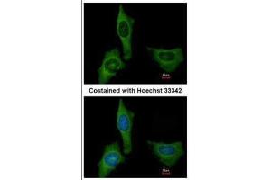 ICC/IF Image Immunofluorescence analysis of methanol-fixed HeLa, using Factor X, antibody at 1:200 dilution.