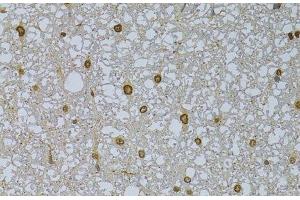 Immunohistochemistry of paraffin-embedded Rat spinal cord using HDGFRP3 Polyclonal Antibody at dilution of 1:100 (40x lens). (HDGFRP3 抗体)